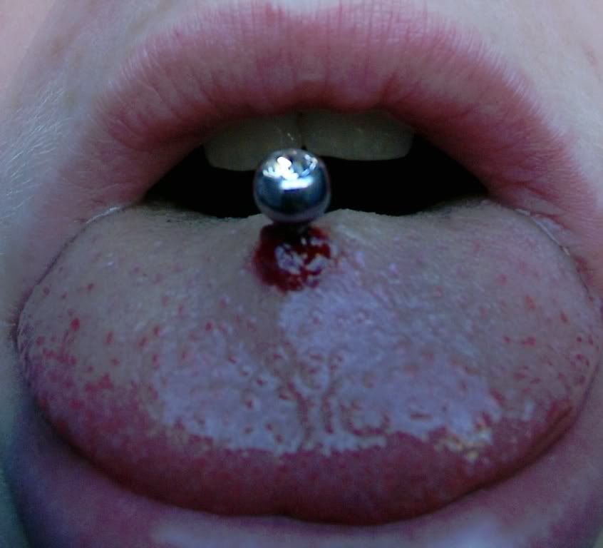 piercing gone wrong?? :S